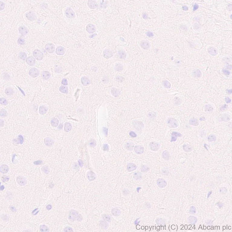 Immunohistochemistry (Formalin/PFA-fixed paraffin-embedded sections) - Anti-Pseudomonas Outer membrane porin F antibody [EPR28629-91] (AB316973)