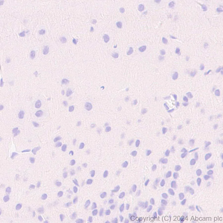 Immunohistochemistry (Formalin/PFA-fixed paraffin-embedded sections) - Anti-Pseudomonas Outer membrane porin F antibody [EPR28629-91] (AB316973)