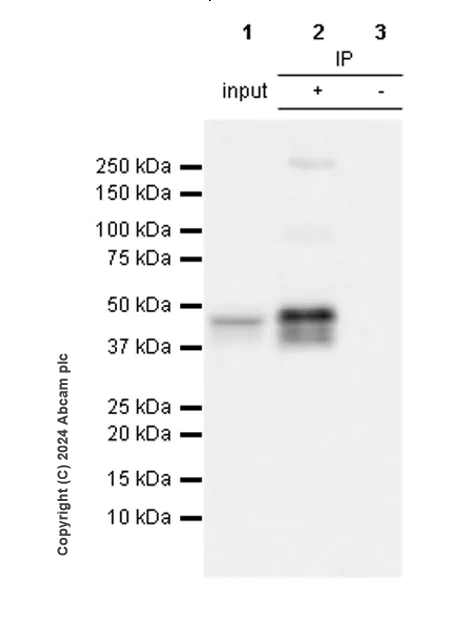 Immunoprecipitation - Anti-Pseudomonas Outer membrane porin F antibody [EPR28629-91] (AB316973)
