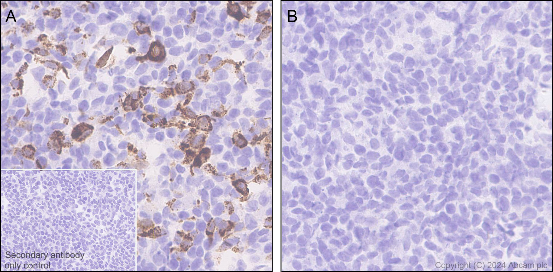 Immunohistochemistry (Formalin/PFA-fixed paraffin-embedded sections) - Anti-Pseudomonas Outer membrane porin F antibody [EPR28629-91] - BSA and Azide free (ab316974), expandable thumbnail