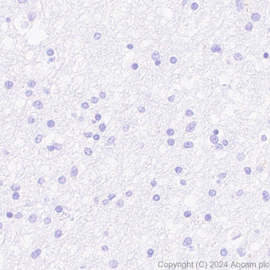 Immunohistochemistry (Formalin/PFA-fixed paraffin-embedded sections) - Anti-Pseudomonas Outer membrane porin F antibody [EPR28629-91] - BSA and Azide free (ab316974), expandable thumbnail