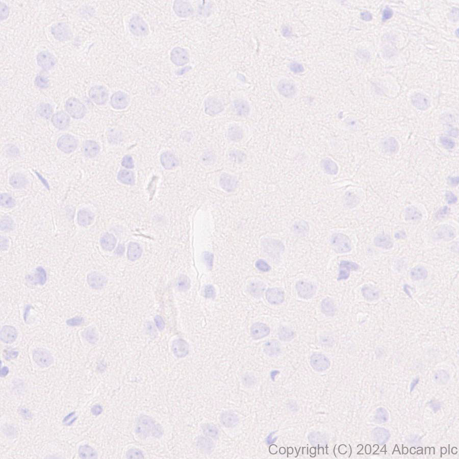 Immunohistochemistry (Formalin/PFA-fixed paraffin-embedded sections) - Anti-Pseudomonas Outer membrane porin F antibody [EPR28629-91] - BSA and Azide free (ab316974), expandable thumbnail