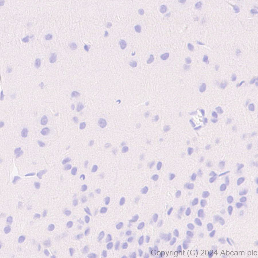 Immunohistochemistry (Formalin/PFA-fixed paraffin-embedded sections) - Anti-Pseudomonas Outer membrane porin F antibody [EPR28629-91] - BSA and Azide free (ab316974), expandable thumbnail