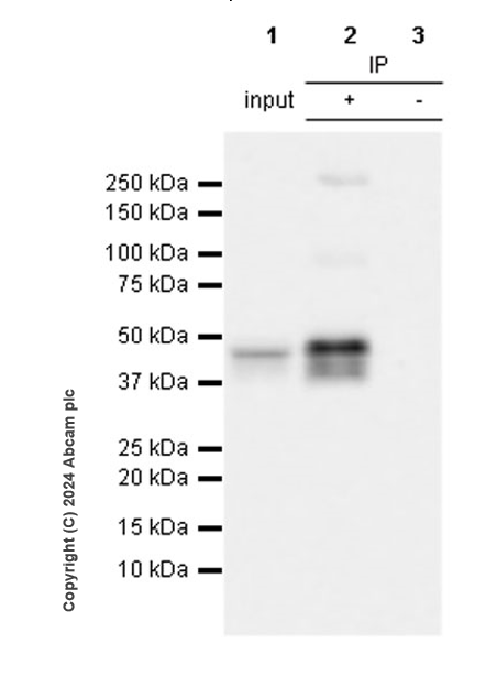 Immunoprecipitation - Anti-Pseudomonas Outer membrane porin F antibody [EPR28629-91] - BSA and Azide free (AB316974), expandable thumbnail