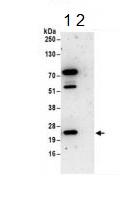 Immunoprecipitation - Anti-PSF1 antibody (AB183524)
