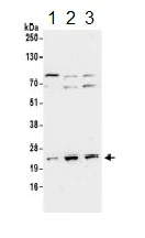 Western blot - Anti-PSF1 antibody (AB183524)