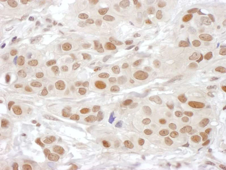 Immunohistochemistry (Formalin/PFA-fixed paraffin-embedded sections) - Anti-PSF3 antibody (AB177515)