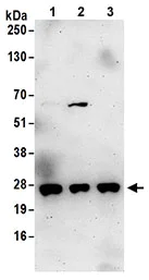 Western blot - Anti-PSF3 antibody (AB177515)