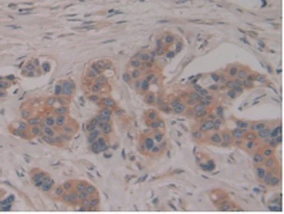 Immunohistochemistry (Formalin/PFA-fixed paraffin-embedded sections) - Anti-PSG1 antibody (AB233130)