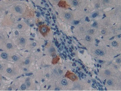 Immunohistochemistry (Formalin/PFA-fixed paraffin-embedded sections) - Anti-PSG1 antibody (AB233130)