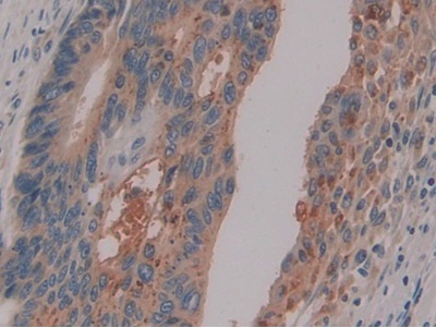 Immunohistochemistry (Formalin/PFA-fixed paraffin-embedded sections) - Anti-PSG1 antibody (AB233130)
