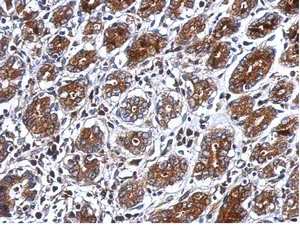 Immunohistochemistry (Formalin/PFA-fixed paraffin-embedded sections) - Anti-PSG3 antibody (AB154700)