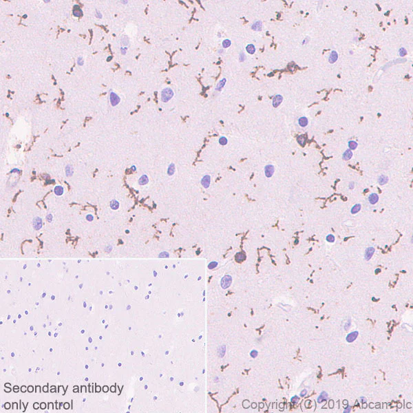 Immunohistochemistry (Formalin/PFA-fixed paraffin-embedded sections) - Anti-PSGL-1 antibody [EPR22504-36] - BSA and Azide free (AB255290)