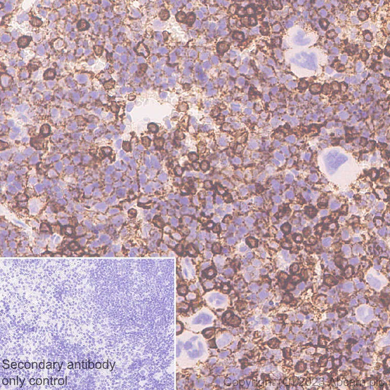 Immunohistochemistry (Formalin/PFA-fixed paraffin-embedded sections) - Anti-PSGL-1 antibody [EPR28170-27] (AB316113)