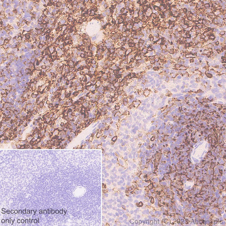 Immunohistochemistry (Formalin/PFA-fixed paraffin-embedded sections) - Anti-PSGL-1 antibody [EPR28170-27] (AB316113)