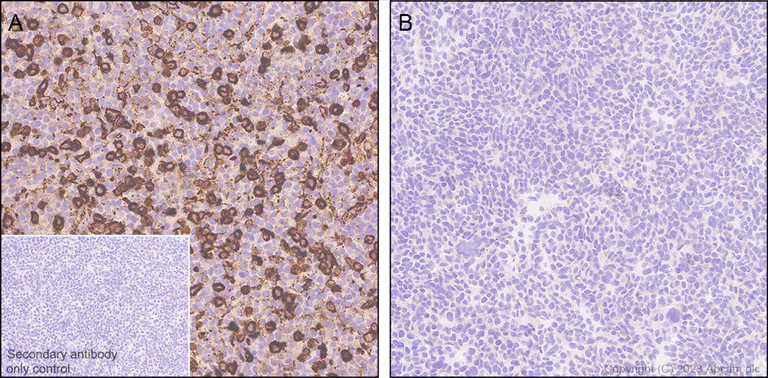 Immunohistochemistry (Formalin/PFA-fixed paraffin-embedded sections) - Anti-PSGL-1 antibody [EPR28170-27] (AB316113)
