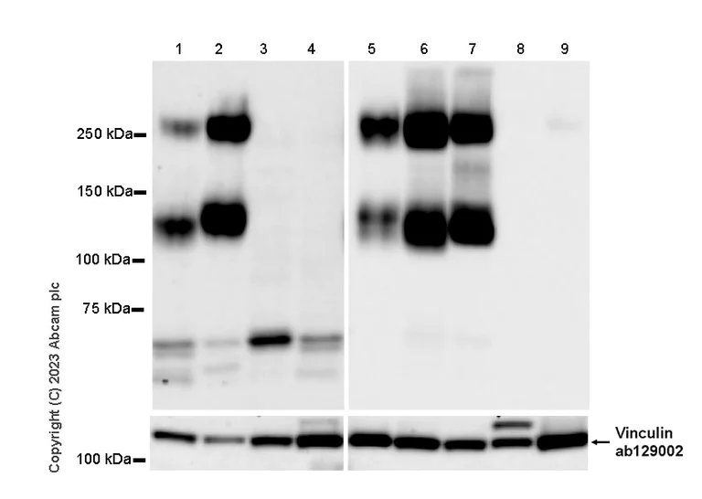 Western blot - Anti-PSGL-1 antibody [EPR28170-27] - BSA and Azide free (AB316114)