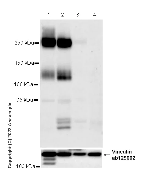 Western blot - Anti-PSGL-1 antibody [EPR28170-27] - BSA and Azide free (AB316114)