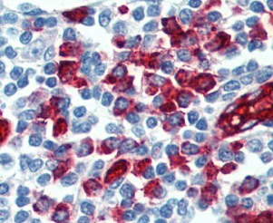 Immunohistochemistry (Formalin/PFA-fixed paraffin-embedded sections) - Anti-PSGL-1 antibody [HECA-452] (AB110096)