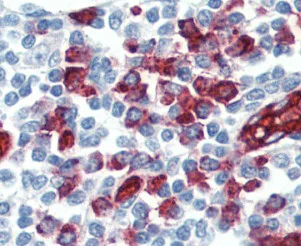 Immunohistochemistry (Formalin/PFA-fixed paraffin-embedded sections) - Anti-PSGL-1 antibody [HECA-452] (AB110096)