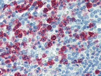 Immunohistochemistry (Formalin/PFA-fixed paraffin-embedded sections) - Anti-PSGL-1 antibody [HECA-452] (AB110096)