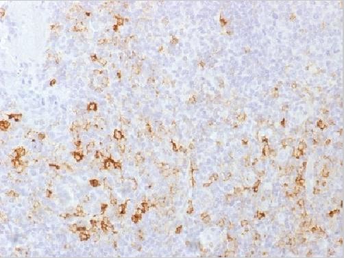 Immunohistochemistry (Formalin/PFA-fixed paraffin-embedded sections) - Anti-PSGL-1 antibody [PSGL1/1601] (AB218518), expandable thumbnail