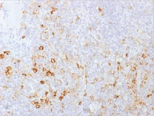 Immunohistochemistry (Formalin/PFA-fixed paraffin-embedded sections) - Anti-PSGL-1 antibody [PSGL1/1601] (AB218518)