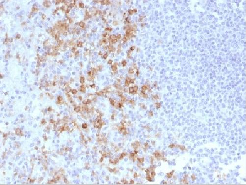 Immunohistochemistry (Formalin/PFA-fixed paraffin-embedded sections) - Anti-PSGL-1 antibody [PSGL1/1601] (AB218518), expandable thumbnail