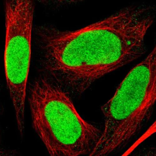 Immunocytochemistry/ Immunofluorescence - Anti-PSIP1/LEDGF antibody (AB244372)