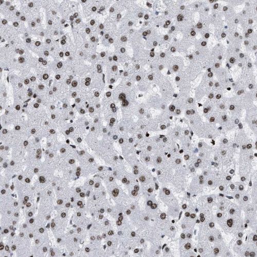 Immunohistochemistry (Formalin/PFA-fixed paraffin-embedded sections) - Anti-PSIP1/LEDGF antibody (AB244372)