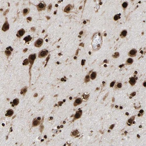 Immunohistochemistry (Formalin/PFA-fixed paraffin-embedded sections) - Anti-PSIP1/LEDGF antibody (AB244372)