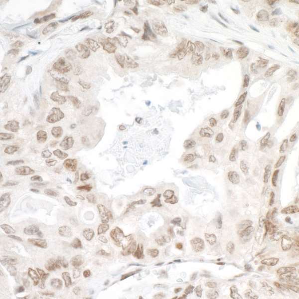 Immunohistochemistry (Formalin/PFA-fixed paraffin-embedded sections) - Anti-PSIP1/LEDGF antibody (AB70641)