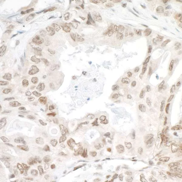 Immunohistochemistry (Formalin/PFA-fixed paraffin-embedded sections) - Anti-PSIP1/LEDGF antibody (AB70641)
