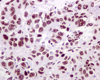 Immunohistochemistry (Formalin/PFA-fixed paraffin-embedded sections) - Anti-PSIP1/LEDGF antibody [EPR11890] - BSA and Azide free (AB249943), expandable thumbnail