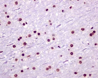Immunohistochemistry (Formalin/PFA-fixed paraffin-embedded sections) - Anti-PSIP1/LEDGF antibody [EPR11890] - BSA and Azide free (AB249943)