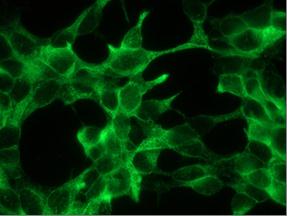 Immunocytochemistry/ Immunofluorescence - Anti-PSMA antibody [107.1A4] (AB140348), expandable thumbnail