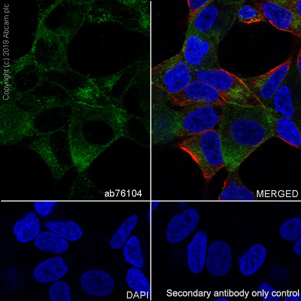 Immunocytochemistry/ Immunofluorescence - Anti-PSMA antibody [EP3253] (AB76104)