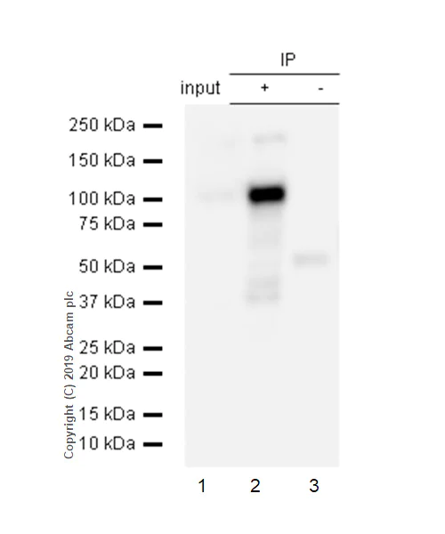 Immunoprecipitation - Anti-PSMA antibody [EP3253] (AB76104)