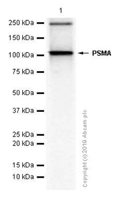 Western blot - Anti-PSMA antibody [EP3253] (AB76104)