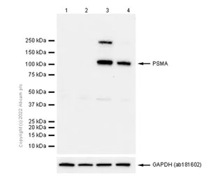 Western blot - Anti-PSMA antibody [EP3253] - BSA and Azide free (AB247436)
