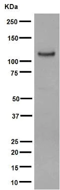 Western blot - Anti-PSMA antibody [EP3254] (AB79542)