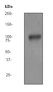 Western blot - Anti-PSMA antibody [EP3254] (AB79542)