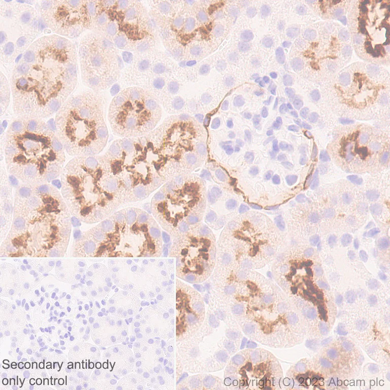 Immunohistochemistry (Formalin/PFA-fixed paraffin-embedded sections) - Anti-PSMA antibody [EPR28358-8] (AB314142)