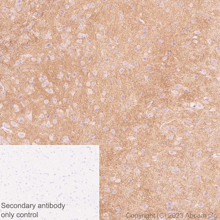 Immunohistochemistry (Formalin/PFA-fixed paraffin-embedded sections) - Anti-PSMA antibody [EPR28358-8] (AB314142)