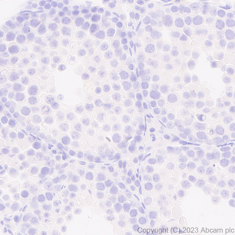 Immunohistochemistry (Formalin/PFA-fixed paraffin-embedded sections) - Anti-PSMA antibody [EPR28358-8] (AB314142)