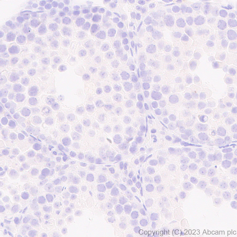 Immunohistochemistry (Formalin/PFA-fixed paraffin-embedded sections) - Anti-PSMA antibody [EPR28358-8] (AB314142)