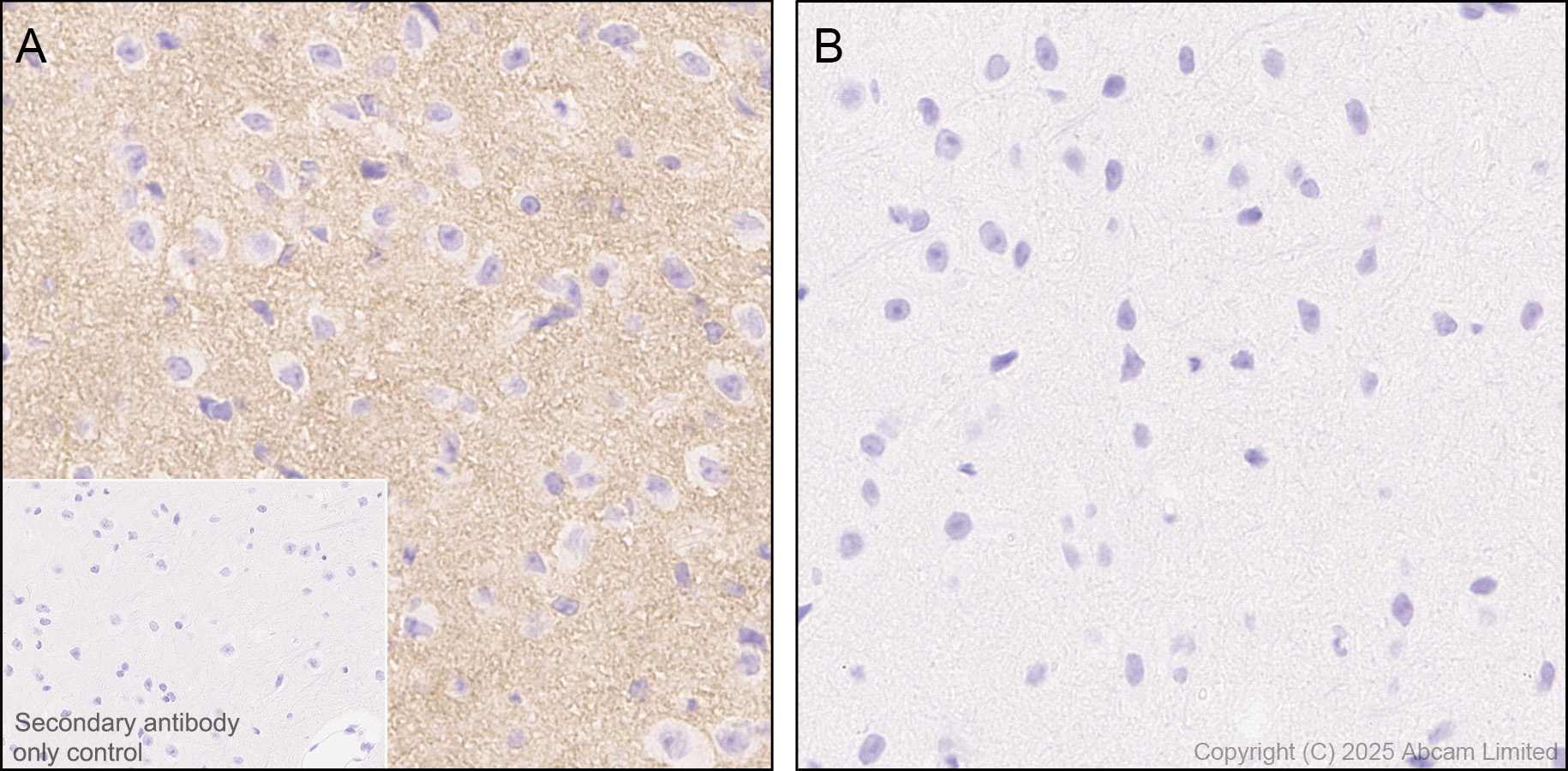 Immunohistochemistry (Formalin/PFA-fixed paraffin-embedded sections) - Anti-PSMA antibody [EPR28358-8] (AB314142)