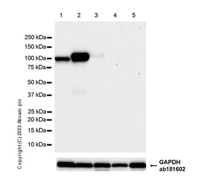 Western blot - Anti-PSMA antibody [EPR28358-8] (AB314142)