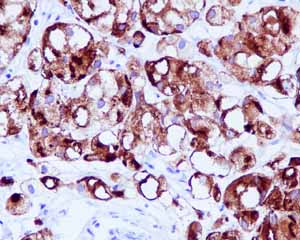 Immunohistochemistry (Formalin/PFA-fixed paraffin-embedded sections) - Anti-PSMA antibody [EPR6253] (AB133579), expandable thumbnail