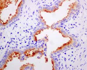 Immunohistochemistry (Formalin/PFA-fixed paraffin-embedded sections) - Anti-PSMA antibody [EPR6253] (ab133579), expandable thumbnail